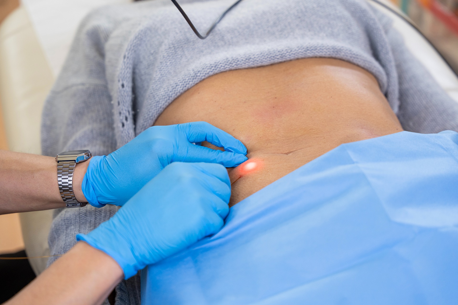 Body contouring procedure